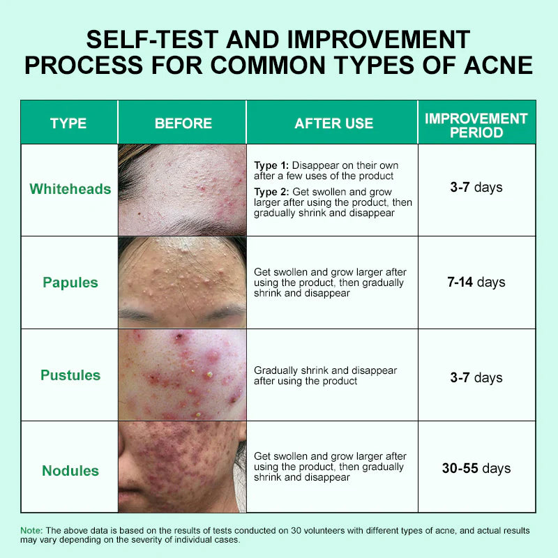 Jelly Prim Double Effect Acne Removing Serum