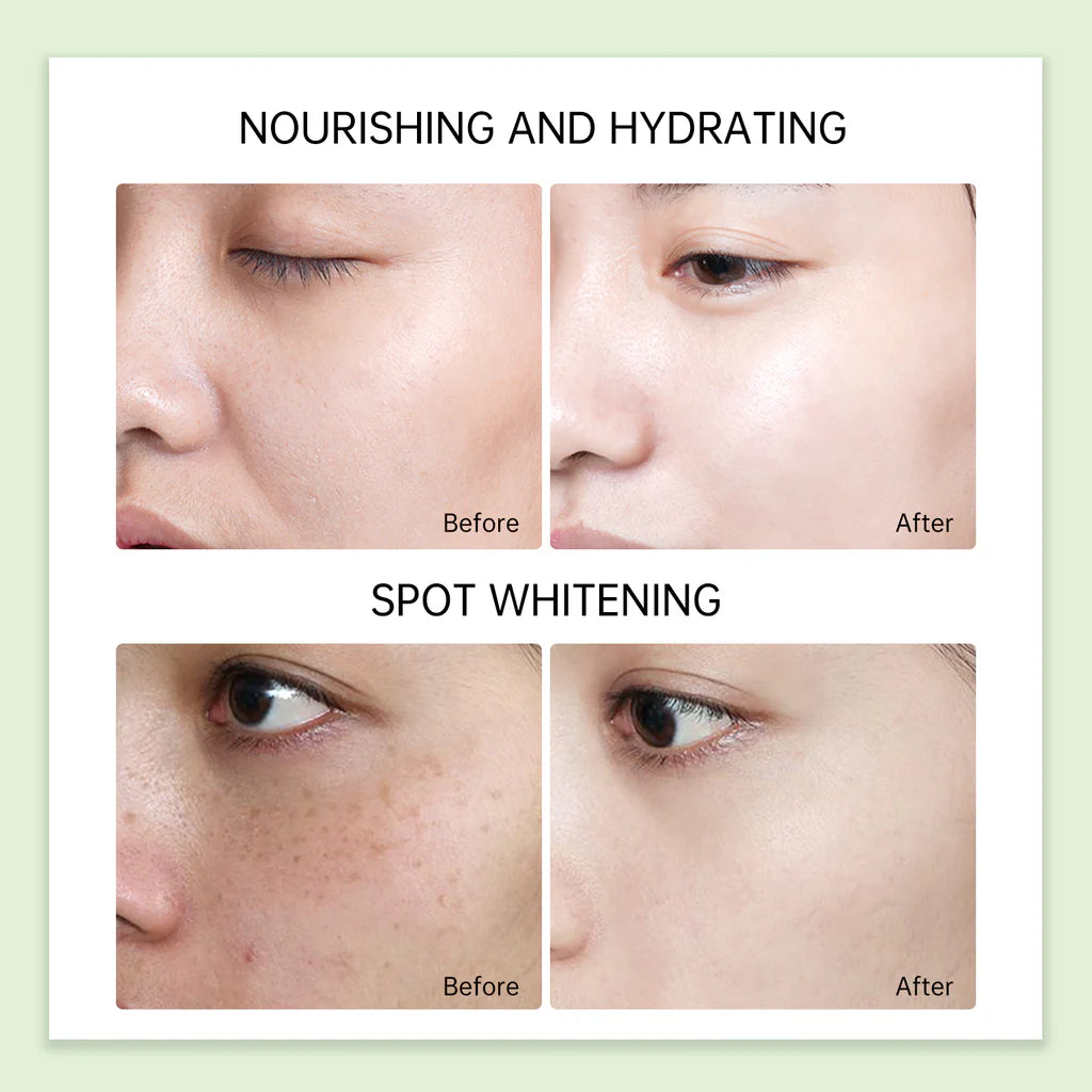 Jelly Prim Australia Tea Tree Essence Acne Recovery Cream