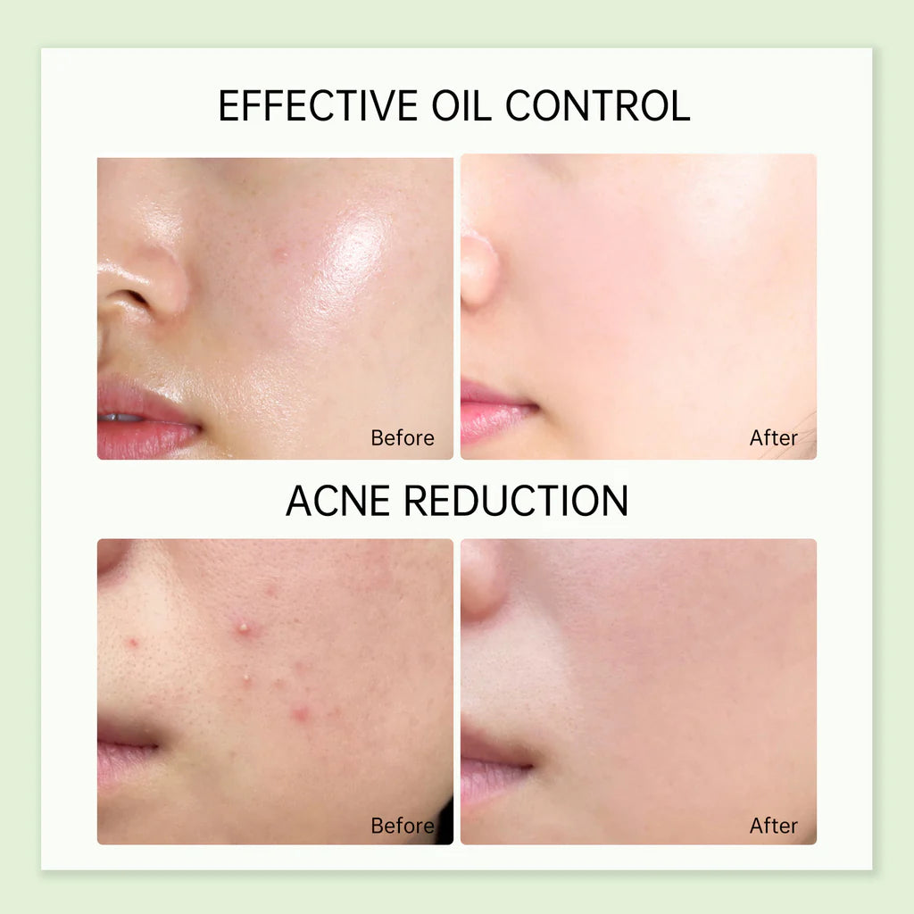 Jelly Prim Australian Tea Tree Refreshing Toner