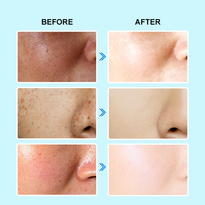 Jelly Prim 3 In 1 Oil-Control And Brightening Serum