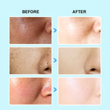 Jelly Prim 3 In 1 Oil-Control And Brightening Serum