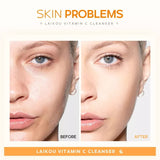 LAIKOU Vitamin C Whitening Cleanser